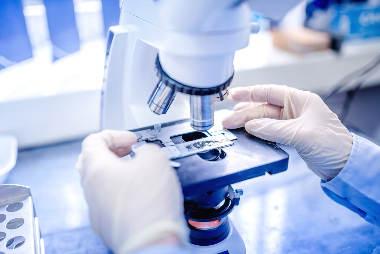 Histopathological